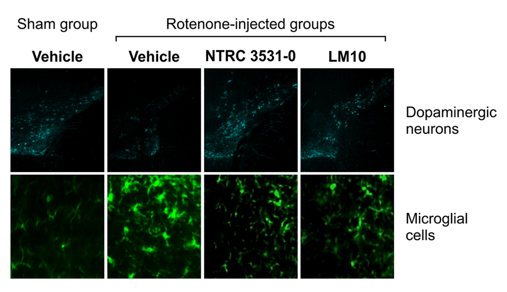 Microscopic Images Of Immuno Labelled Dopaminergic And Microglial Cells In The Substantia Nigra Of Mice